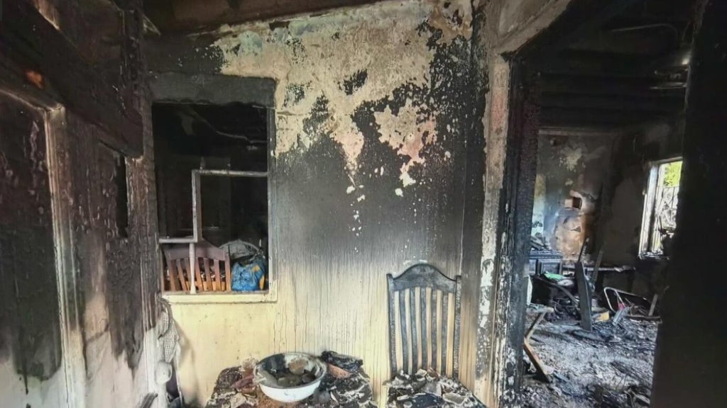 Woman hospitalized after Miami house fire leaves three displaced — CBS Miami, Seoul Health news